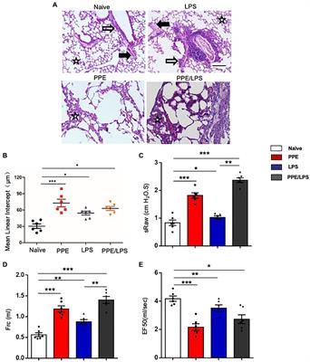 The Heterogeneity of Inflammatory Response and Emphysema in Chronic Obstructive Pulmonary Disease